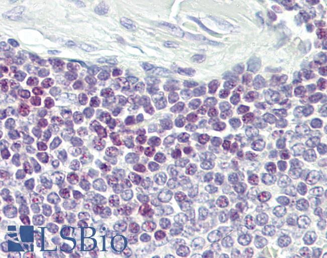 ELF1 Antibody - Anti-ELF1 antibody IHC of human spleen. Immunohistochemistry of formalin-fixed, paraffin-embedded tissue after heat-induced antigen retrieval. Antibody dilution 5-7.5 ug/ml.  This image was taken for the unconjugated form of this product. Other forms have not been tested.