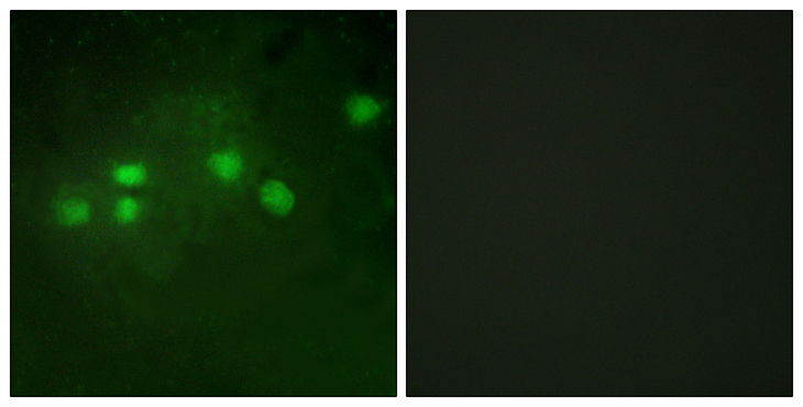 ELF1 Antibody - Immunofluorescence analysis of A549 cells, using ELF1 Antibody. The picture on the right is blocked with the synthesized peptide.