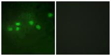 ELF1 Antibody - Immunofluorescence analysis of A549 cells, using ELF1 Antibody. The picture on the right is blocked with the synthesized peptide.