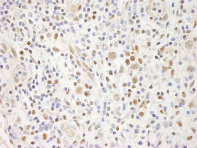 ELF1 Antibody - Detection of Human ELF1 Immunohistochemistry. Sample: FFPE section of human Hodgkin's Lymphoma. Antibody: Affinity purified rabbit anti-ELF1 used at a dilution of 1:250.
