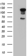 ELF1 Antibody - HEK293T cells were transfected with the pCMV6-ENTRY control. (Left lane) or pCMV6-ENTRY ELF1. (Right lane) cDNA for 48 hrs and lysed. Equivalent amounts of cell lysates. (5 ug per lane) were separated by SDS-PAGE and immunoblotted with anti-ELF1. (1:2000)