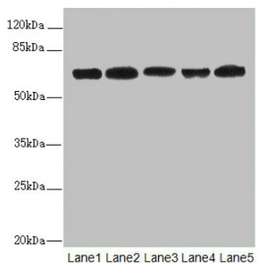 ELF2 / NERF Antibody - Western blot All Lanes:ELF2 antibody at 2.27ug/ml Lane 1 : HL60 whole cell lysate Lane 2 : A549 whole cell lysate Lane 3 : MCF7 whole cell lysate Lane 4 : Jurkat whole cell lysate Lane 5 : Hela whole cell lysate Secondary Goat polyclonal to Rabbit IgG at 1/10000 dilution Predicted band size: 64,63,57,58,55 kDa Observed band size: 64,50 kDa