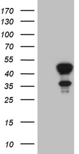 ELF3 / ESE1 Antibody - HEK293T cells were transfected with the pCMV6-ENTRY control. (Left lane) or pCMV6-ENTRY ELF3. (Right lane) cDNA for 48 hrs and lysed. Equivalent amounts of cell lysates. (5 ug per lane) were separated by SDS-PAGE and immunoblotted with anti-ELF3. (1:2000)