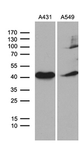 ELF3 / ESE1 Antibody - Western blot analysis of extracts. (35ug) from 2 different cell lines by using anti-ELF3 monoclonal antibody. (1:500)