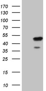 ELF3 / ESE1 Antibody - HEK293T cells were transfected with the pCMV6-ENTRY control. (Left lane) or pCMV6-ENTRY ELF3. (Right lane) cDNA for 48 hrs and lysed. Equivalent amounts of cell lysates. (5 ug per lane) were separated by SDS-PAGE and immunoblotted with anti-ELF3. (1:2000)