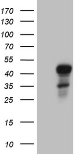 ELF3 / ESE1 Antibody - HEK293T cells were transfected with the pCMV6-ENTRY control. (Left lane) or pCMV6-ENTRY ELF3. (Right lane) cDNA for 48 hrs and lysed