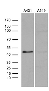ELF3 / ESE1 Antibody - Western blot analysis of extracts. (35ug) from 2 different cell lines by using anti-ELF3 monoclonal antibody. (1:500)