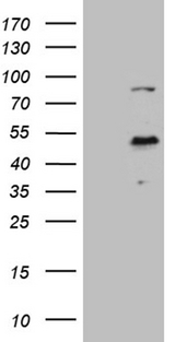 ELF3 / ESE1 Antibody - HEK293T cells were transfected with the pCMV6-ENTRY control. (Left lane) or pCMV6-ENTRY ELF3. (Right lane) cDNA for 48 hrs and lysed