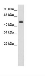 ELF3 / ESE1 Antibody - Fetal Thymus Lysate.  This image was taken for the unconjugated form of this product. Other forms have not been tested.