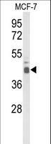 ELF3 / ESE1 Antibody - Western blot of ELF3 Antibody in MCF-7 cell line lysates (35 ug/lane). ELF3 (arrow) was detected using the purified antibody.