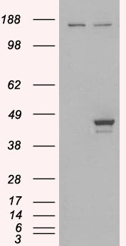 ELF3 / ESE1 Antibody - HEK293 overexpressing ELF3 (RC200631) and probed with (mock transfection in first lane).