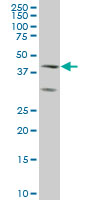 ELF3 / ESE1 Antibody - ELF3 monoclonal antibody (M01), clone 1D8 Western Blot analysis of ELF3 expression in A-431.