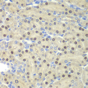 ELF3 / ESE1 Antibody - Immunohistochemistry of paraffin-embedded rat kidney tissue.
