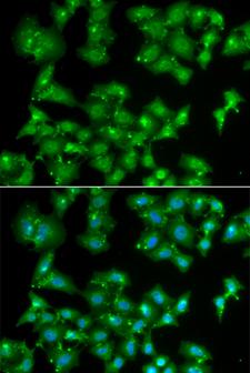 ELF3 / ESE1 Antibody - Immunofluorescence analysis of A549 cells.