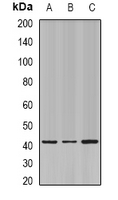 ELF3 / ESE1 Antibody - Western blot analysis of ESE-1 expression in SW480 (A); mouse skin (B); mouse lung (C) whole cell lysates.