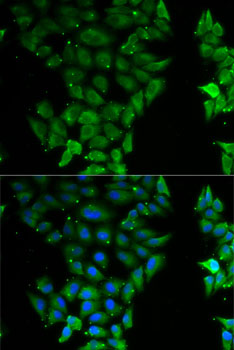 ELF3 / ESE1 Antibody - Immunofluorescence analysis of MCF7 cells using ELF3 antibody. Blue: DAPI for nuclear staining.