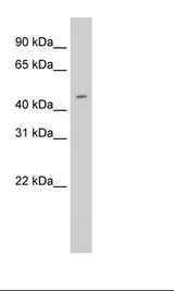 ELF3 / ESE1 Antibody - Trachea Lysate.  This image was taken for the unconjugated form of this product. Other forms have not been tested.