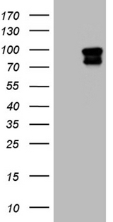 ELF4 / MEF Antibody - HEK293T cells were transfected with the pCMV6-ENTRY control. (Left lane) or pCMV6-ENTRY ELF4. (Right lane) cDNA for 48 hrs and lysed. Equivalent amounts of cell lysates. (5 ug per lane) were separated by SDS-PAGE and immunoblotted with anti-ELF4. (1:2000)