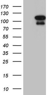 ELF4 / MEF Antibody - HEK293T cells were transfected with the pCMV6-ENTRY control. (Left lane) or pCMV6-ENTRY ELF4. (Right lane) cDNA for 48 hrs and lysed. Equivalent amounts of cell lysates. (5 ug per lane) were separated by SDS-PAGE and immunoblotted with anti-ELF4. (1:2000)