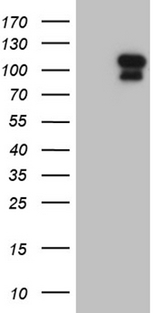 ELF4 / MEF Antibody - HEK293T cells were transfected with the pCMV6-ENTRY control. (Left lane) or pCMV6-ENTRY ELF4. (Right lane) cDNA for 48 hrs and lysed. Equivalent amounts of cell lysates. (5 ug per lane) were separated by SDS-PAGE and immunoblotted with anti-ELF4. (1:2000)