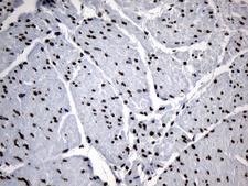 ELF4 / MEF Antibody - Immunohistochemical staining of paraffin-embedded Human bladder tissue within the normal limits using anti-ELF4 mouse monoclonal antibody. (Heat-induced epitope retrieval by 1mM EDTA in 10mM Tris buffer. (pH8.5) at 120°C for 3 min. (1:500)