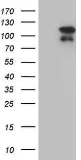 ELF4 / MEF Antibody - HEK293T cells were transfected with the pCMV6-ENTRY control. (Left lane) or pCMV6-ENTRY ELF4. (Right lane) cDNA for 48 hrs and lysed. Equivalent amounts of cell lysates. (5 ug per lane) were separated by SDS-PAGE and immunoblotted with anti-ELF4. (1:2000)