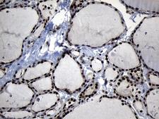 ELF4 / MEF Antibody - Immunohistochemical staining of paraffin-embedded Human thyroid tissue within the normal limits using anti-ELF4 mouse monoclonal antibody. (Heat-induced epitope retrieval by 1mM EDTA in 10mM Tris buffer. (pH8.5) at 120°C for 3 min. (1:150)