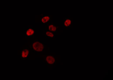 ELF4 / MEF Antibody - Staining HepG2 cells by IF/ICC. The samples were fixed with PFA and permeabilized in 0.1% Triton X-100, then blocked in 10% serum for 45 min at 25°C. The primary antibody was diluted at 1:200 and incubated with the sample for 1 hour at 37°C. An Alexa Fluor 594 conjugated goat anti-rabbit IgG (H+L) Ab, diluted at 1/600, was used as the secondary antibody.