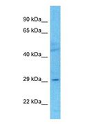 ELF5 Antibody - Western blot of ELF5 Antibody with human COLO205 Whole Cell lysate.  This image was taken for the unconjugated form of this product. Other forms have not been tested.
