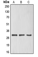 ELF5 Antibody - Western blot analysis of ELF5 expression in HeLa (A); HUVEC (B); Jurkat (C) whole cell lysates.