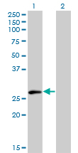ELF5 Antibody - Western Blot analysis of ELF5 expression in transfected 293T cell line by ELF5 monoclonal antibody (M01), clone 3D10.Lane 1: ELF5 transfected lysate(30.1 KDa).Lane 2: Non-transfected lysate.