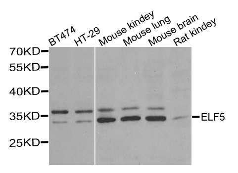 ELF5 Antibody - Western blot analysis of extracts of various cells.