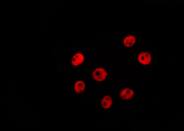 ELF5 Antibody - Staining LOVO cells by IF/ICC. The samples were fixed with PFA and permeabilized in 0.1% Triton X-100, then blocked in 10% serum for 45 min at 25°C. The primary antibody was diluted at 1:200 and incubated with the sample for 1 hour at 37°C. An Alexa Fluor 594 conjugated goat anti-rabbit IgG (H+L) Ab, diluted at 1/600, was used as the secondary antibody.