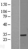 ELF5 Protein - Western validation with an anti-DDK antibody * L: Control HEK293 lysate R: Over-expression lysate