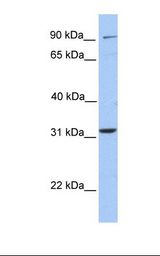 ELFN2 Antibody - 721_B cell lysate. Antibody concentration: 1.0 ug/ml. Gel concentration: 12%.  This image was taken for the unconjugated form of this product. Other forms have not been tested.
