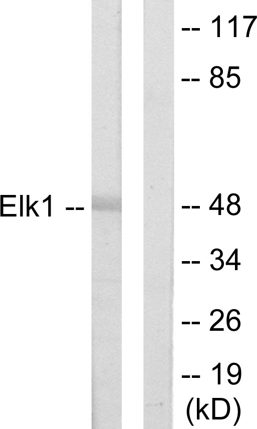 ELK1 Antibody - Western blot analysis of lysates from HeLa cells, using Elk1 Antibody. The lane on the right is blocked with the synthesized peptide.