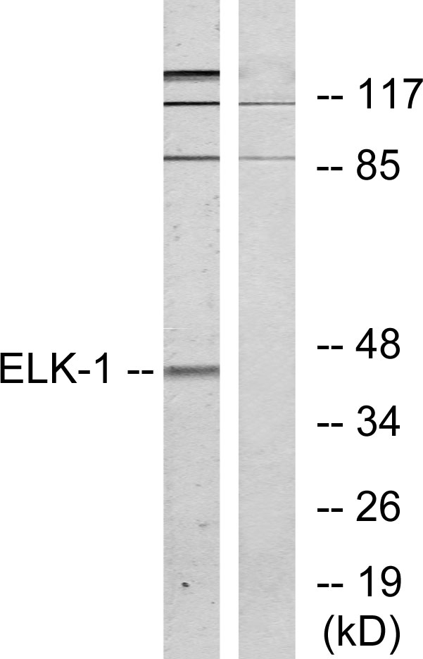 ELK1 Antibody - Western blot analysis of lysates from HeLa cells, treated with heat shock, using Elk1 Antibody. The lane on the right is blocked with the synthesized peptide.