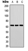 ELK1 Antibody - Western blot analysis of ELK1 expression in Jurkat (A); mouse kidney (B); rat lung (C) whole cell lysates.