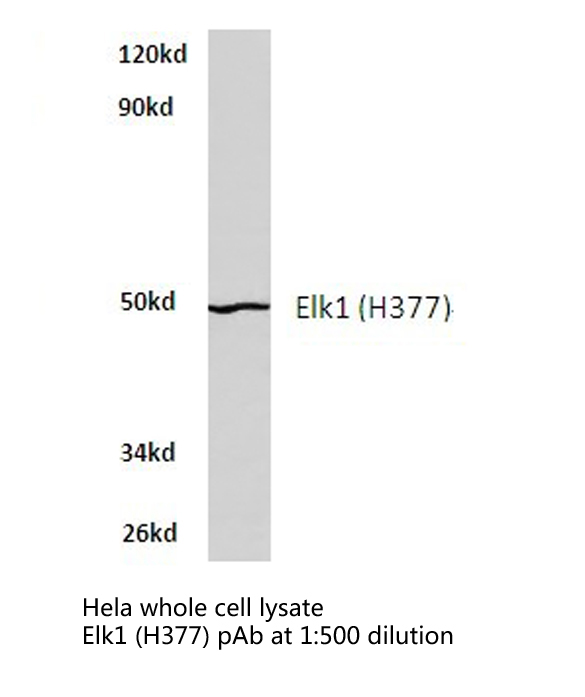 ELK1 Antibody - Western blot of Elk1 (H377) pAb in extracts from HeLa cells.