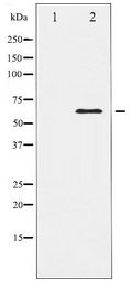 ELK1 Antibody - Western blot of Elk1 expression in HeLa whole cell lysates,The lane on the left is treated with the antigen-specific peptide.