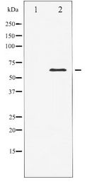 ELK1 Antibody - Western blot of Elk1 expression in heatshock treated HeLa whole cell lysates,The lane on the left is treated with the antigen-specific peptide.