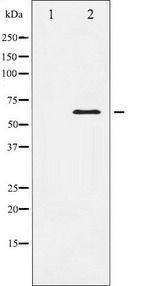 ELK1 Antibody - Western blot analysis of Elk1 expression in HeLa whole cells lysates. The lane on the left is treated with the antigen-specific peptide.