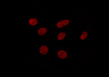 ELK1 Antibody - Staining HeLa cells by IF/ICC. The samples were fixed with PFA and permeabilized in 0.1% Triton X-100, then blocked in 10% serum for 45 min at 25°C. The primary antibody was diluted at 1:200 and incubated with the sample for 1 hour at 37°C. An Alexa Fluor 594 conjugated goat anti-rabbit IgG (H+L) Ab, diluted at 1/600, was used as the secondary antibody.