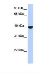 ELK1 Antibody - Fetal brain lysate. Antibody concentration: 1.0 ug/ml. Gel concentration: 12%.  This image was taken for the unconjugated form of this product. Other forms have not been tested.