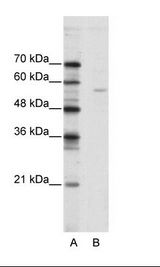 ELK1 Antibody - A: Marker, B: Jurkat Cell Lysate.  This image was taken for the unconjugated form of this product. Other forms have not been tested.