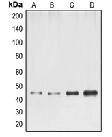 ELK1 Antibody - Western blot analysis of ELK1 expression in HeLa (A); NIH3T3 (B); mouse liver (C); rat liver (D) whole cell lysates.