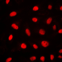 ELK1 Antibody - Immunofluorescent analysis of ELK1 staining in NIH3T3 cells. Formalin-fixed cells were permeabilized with 0.1% Triton X-100 in TBS for 5-10 minutes and blocked with 3% BSA-PBS for 30 minutes at room temperature. Cells were probed with the primary antibody in 3% BSA-PBS and incubated overnight at 4 C in a humidified chamber. Cells were washed with PBST and incubated with a DyLight 594-conjugated secondary antibody (red) in PBS at room temperature in the dark. DAPI was used to stain the cell nuclei (blue).