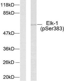 ELK1 Antibody - Western blot analysis of lysates from HeLa cells treated with UV, using Elk1 (Phospho-Ser383) Antibody. The lane on the left is blocked with the phospho peptide.