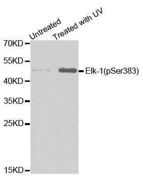 ELK1 Antibody - Western blot analysis of extracts from HT29 cells untreated or treated with UV.