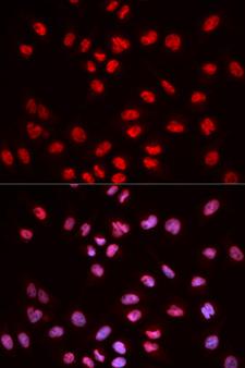 ELK1 Antibody - Immunofluorescence analysis of MCF7 cells.